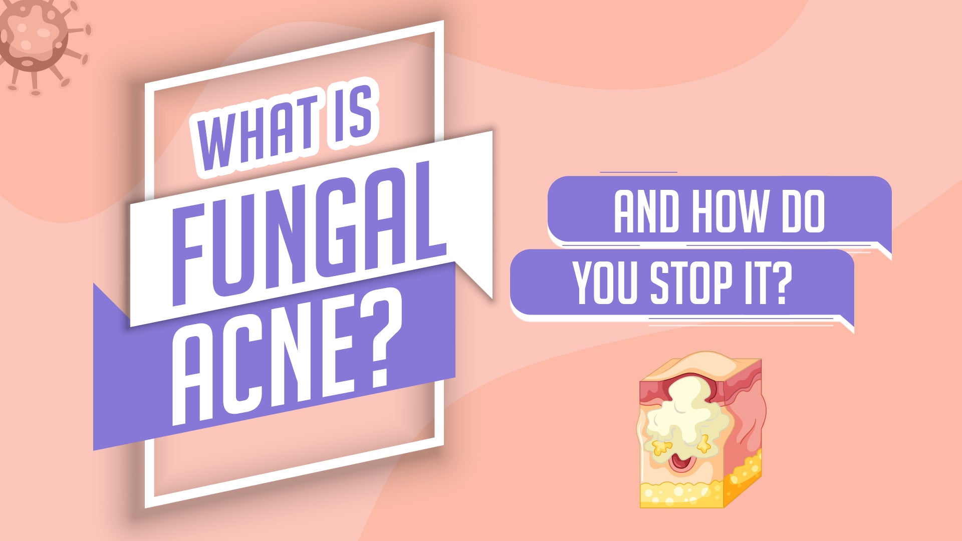 What is Fungal Acne?