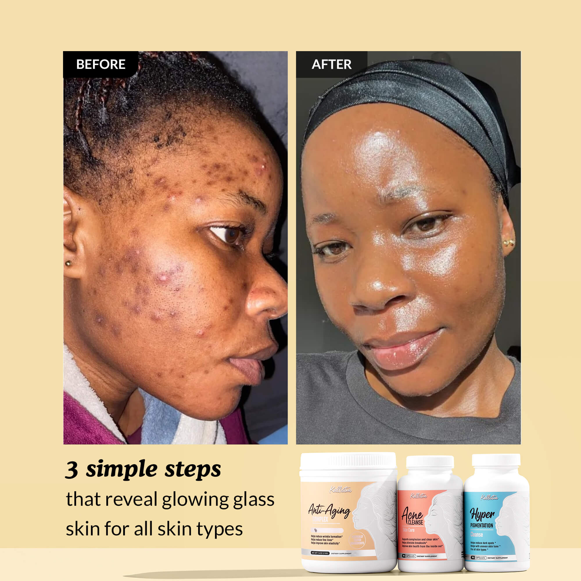 Perfect Skin Kit