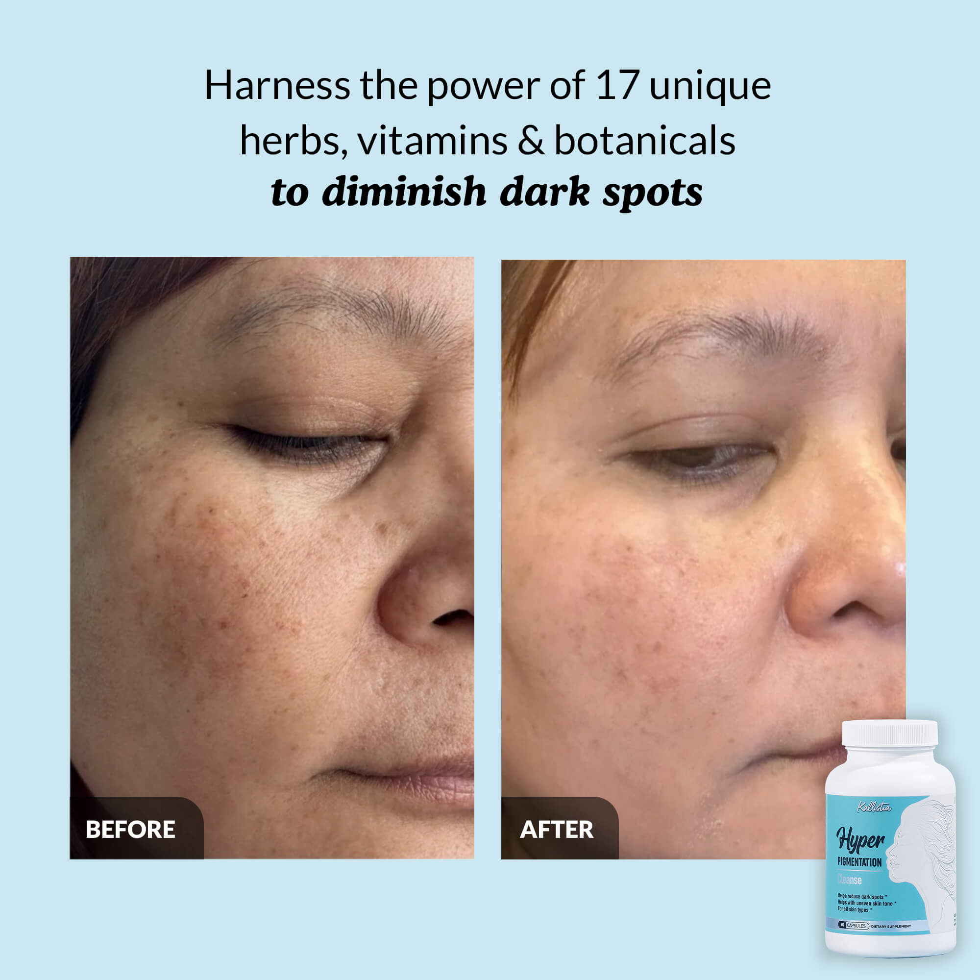 Κάψουλες Hyperpigmentation Cleanse